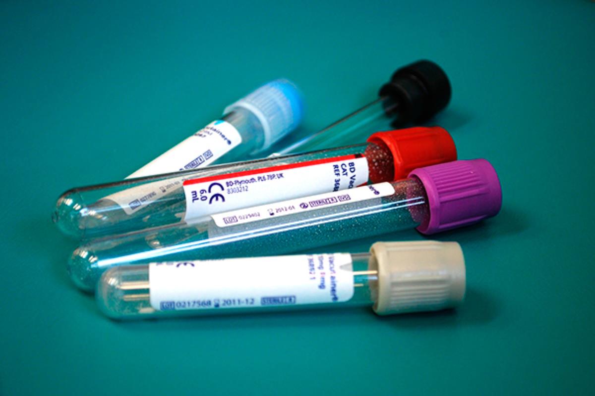 La Comunidad de Madrid adquiere seis lotes de material por un valor de 8,78 millones de euros