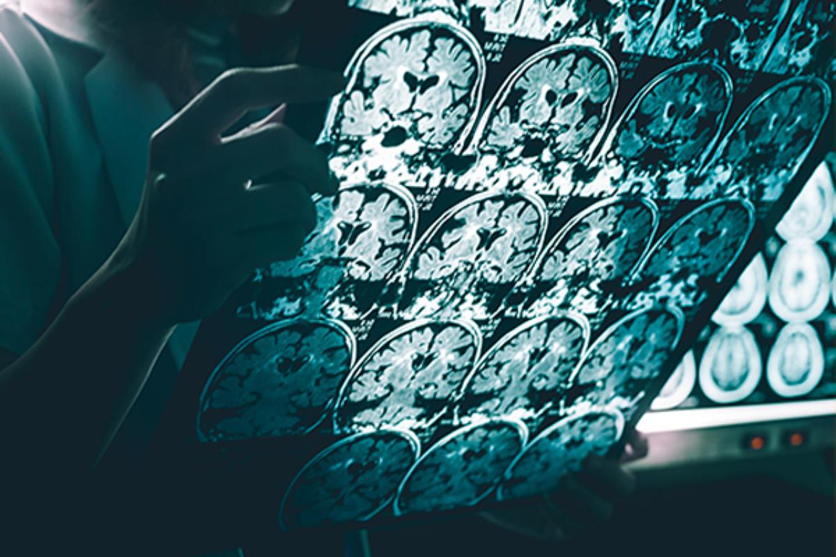 ¿Sabemos realmente el significado del Alzheimer?