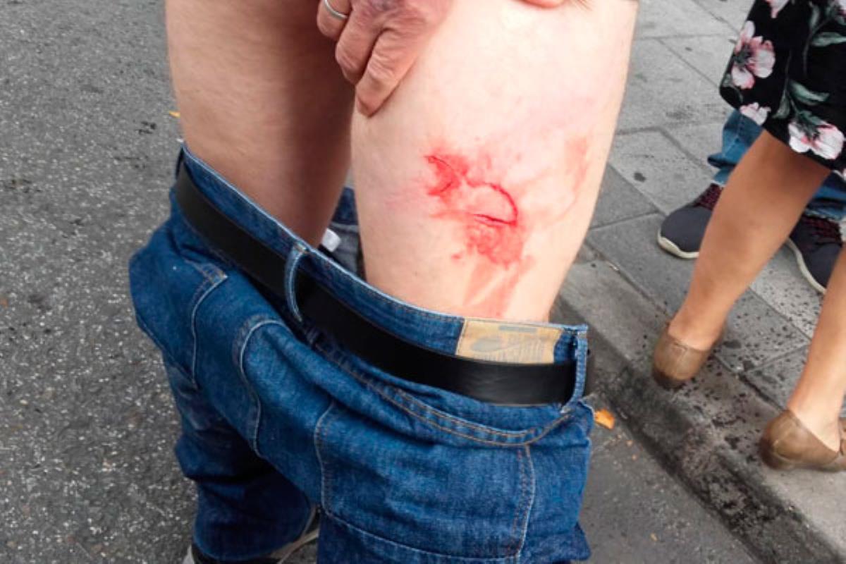 Tras una confusión que enfrentó a los activistas con los cerrajeros, se desataron las cargas policiales