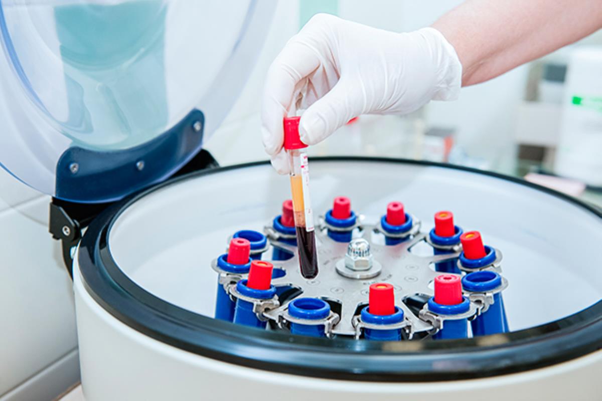 Una novedosa prueba distingue tumores malignos y benignos de mama, en un lapso de 5 horas