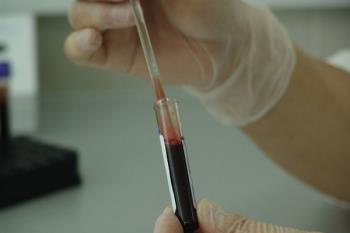 El tratamiento se basa en la modificación de linfocitos del paciente o la paciente