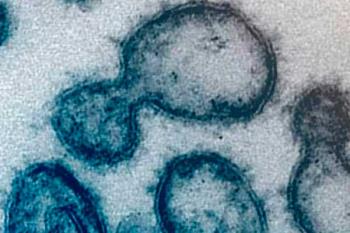 El genoma secuenciado del virus latente en tres pacientes de Valencia revela diferencias con el origen de la pandemia