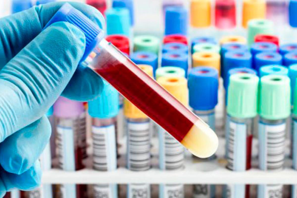 Trabajadores, sindicatos y oposición afirman que “es el momento de revertir” la situación ante el final del contrato 