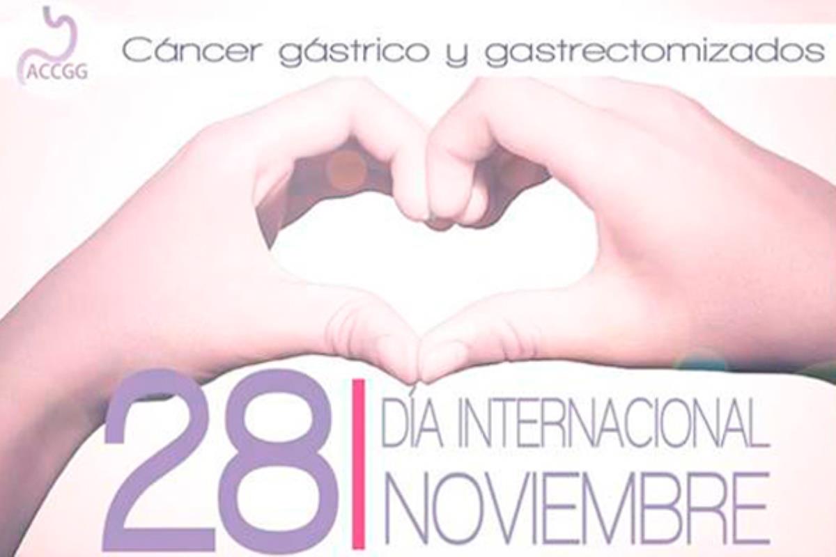 El cáncer de estómago es el sexto cáncer más común en España