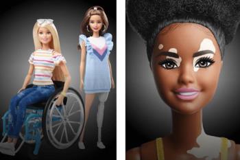 La línea ‘Barbie Fashionista’ cuenta con muñecas con vitíligo, calvas o con prótesis