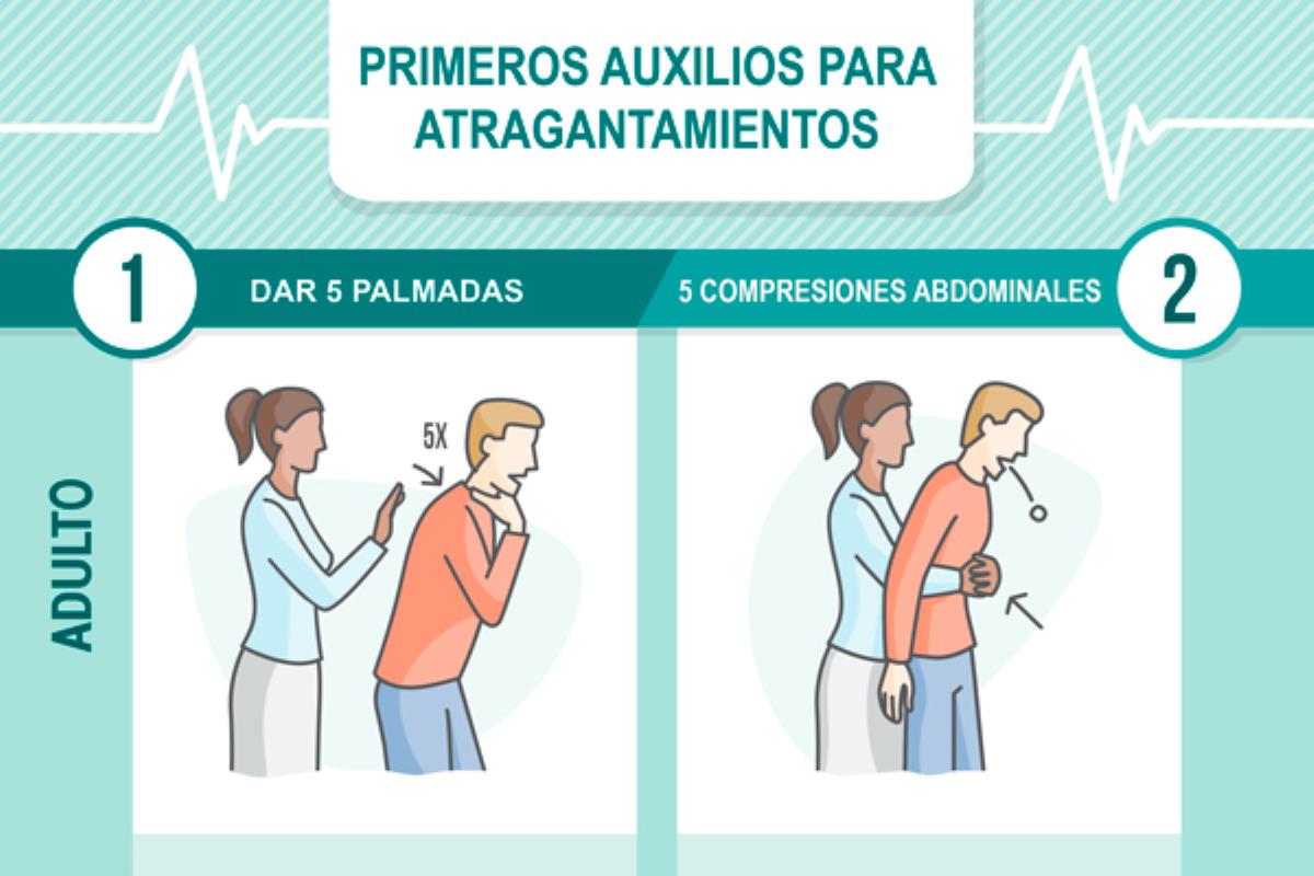 Cómo se practica la maniobra Heimlich y cuándo realizarla