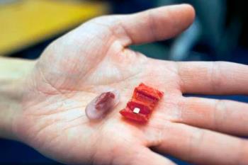 La tecnología diminuta podría extraer de nuestro aparato digestivo pequeños cuerpos extraños o tratar pequeñas heridas