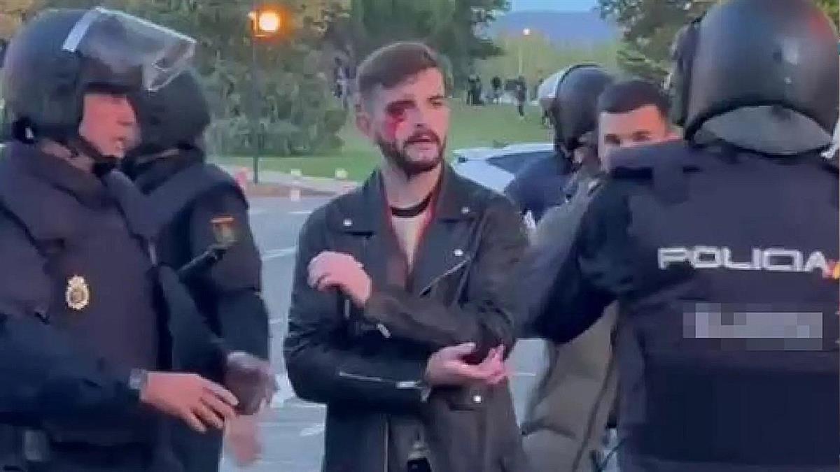 El profesional estaba informando de los disturbios en la Universidad de Navarra