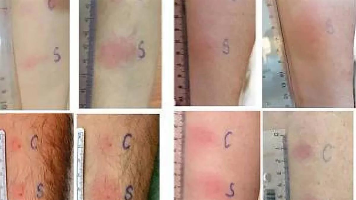 Este nuevo procedimiento es mucho más efectivo que los test de antígenos que se utilizan en la actualidad 
