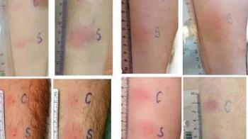 Este nuevo procedimiento es mucho más efectivo que los test de antígenos que se utilizan en la actualidad 
