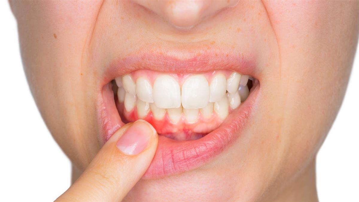 La salud general empieza por la boca 
 