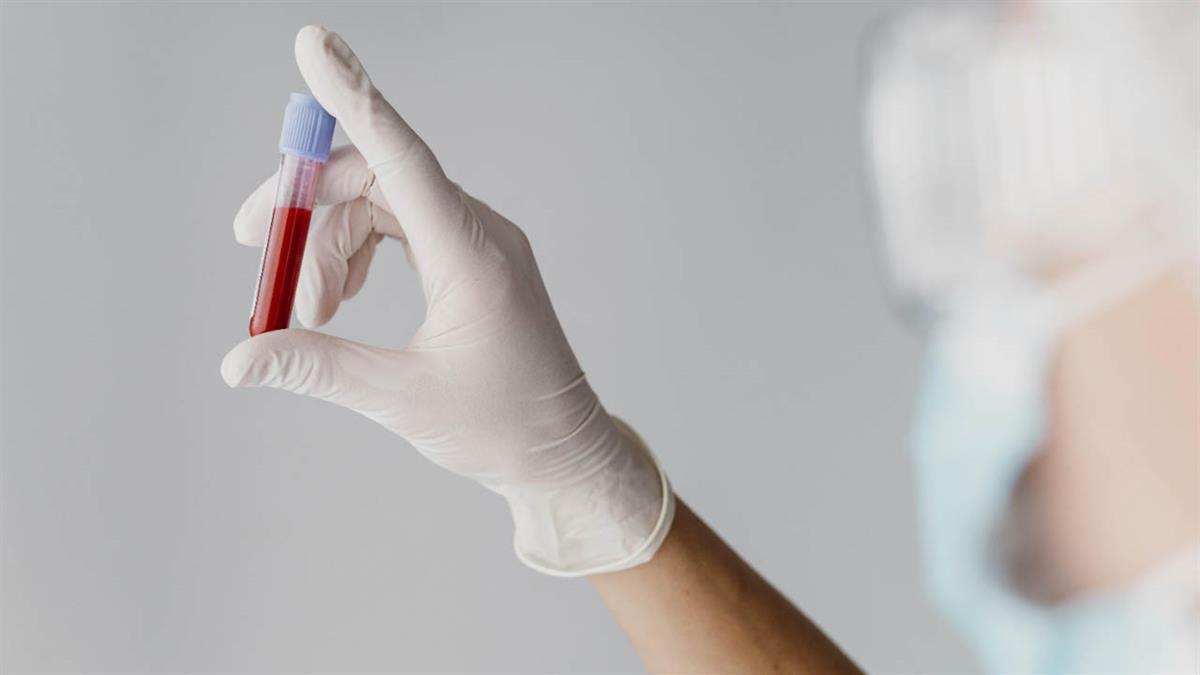 El objetivo es reforzar las reservas de cara a las próximas necesidades