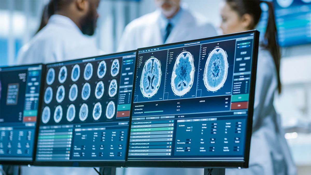 Según un estudio publicado en el European Journal of Neurology