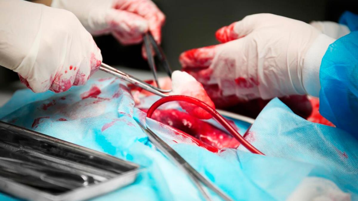 El hospital madrileño ha realizado 64 operaciones de este tipo a niños en 2020