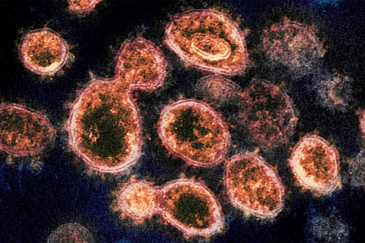 El 90% del presupuesto del Fondo COVID se ha concedido para financiar 117 proyectos