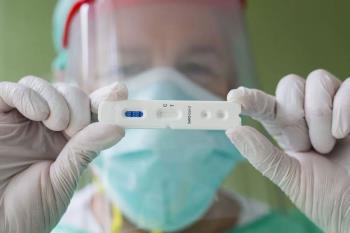 Ya son más de 450.000 las pruebas realizadas