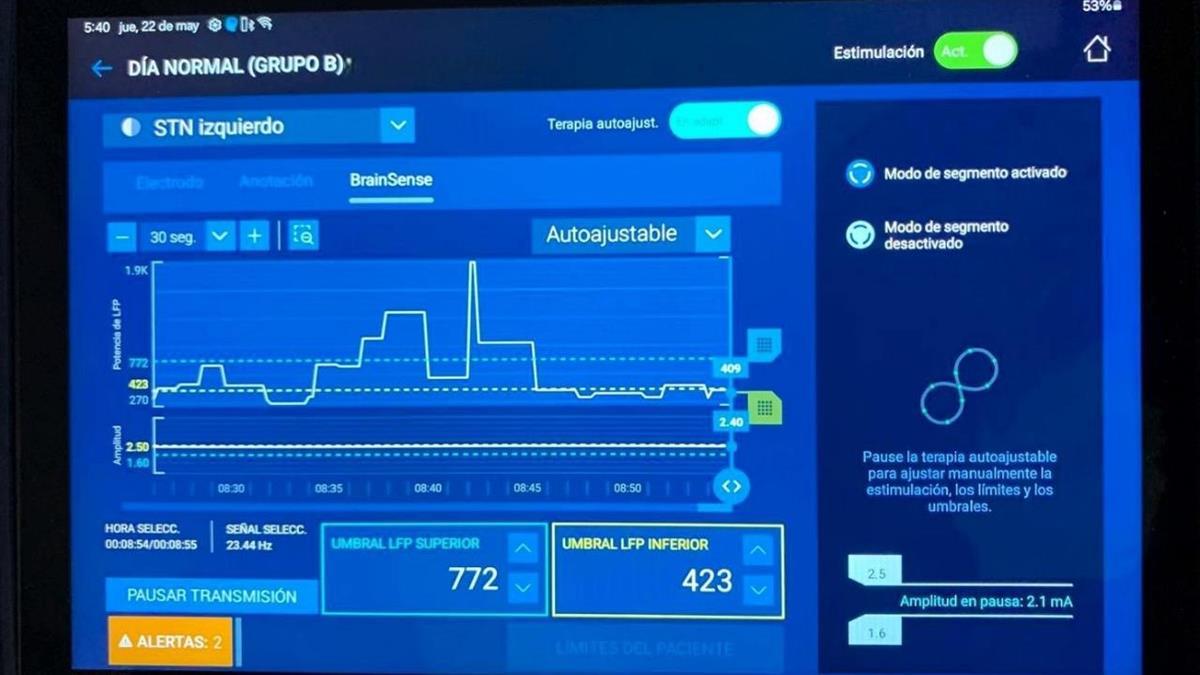 El Hospital Rey Juan Carlos incorpora este tratamiento personalizado