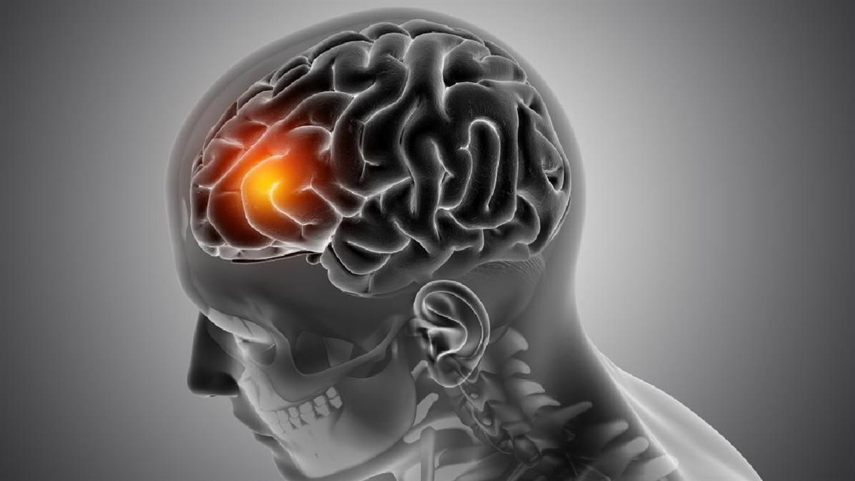 Investigadores del Hospital público Fundación Alcorcón identifican una nueva variante genética