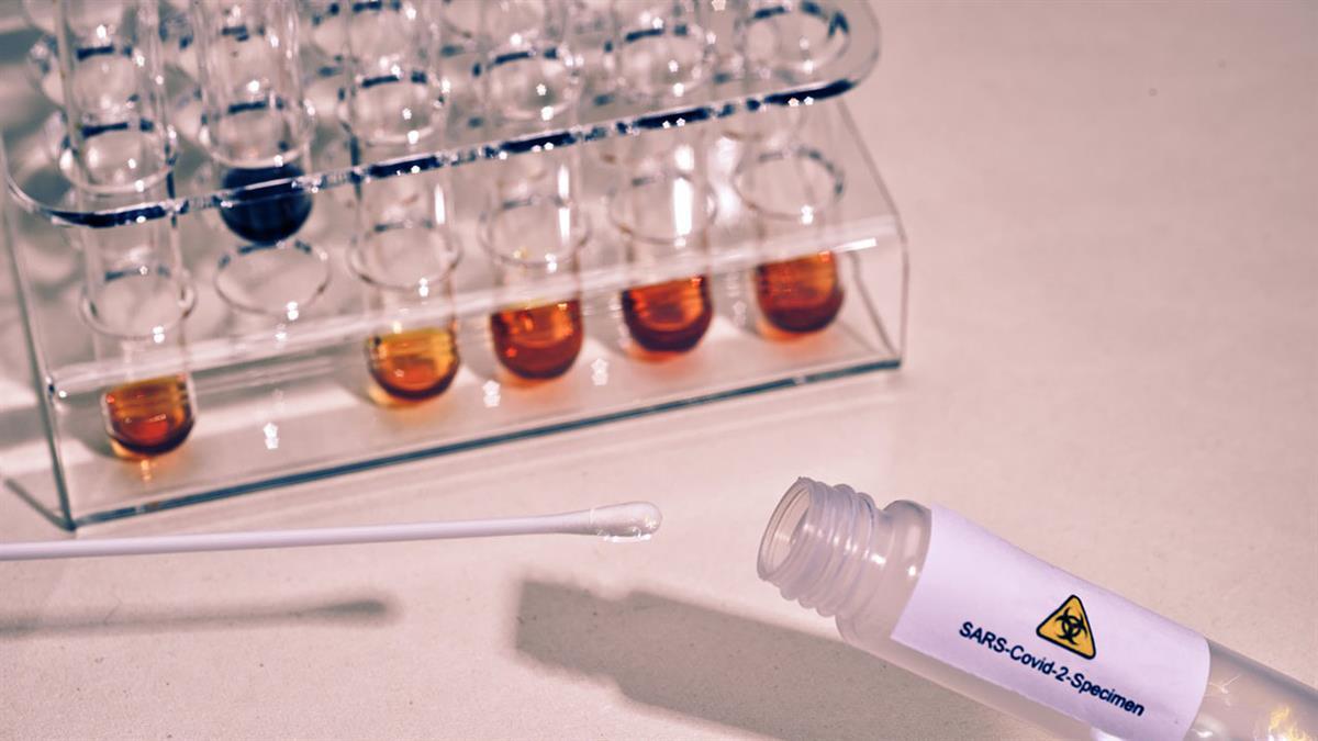 Estas pruebas pertenecían a cuatro marcas distintas e incumplían las normas sanitarias establecidas