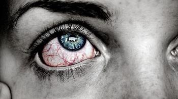 Durante la pandemia se ha registrado un aumento de patologías oculares.