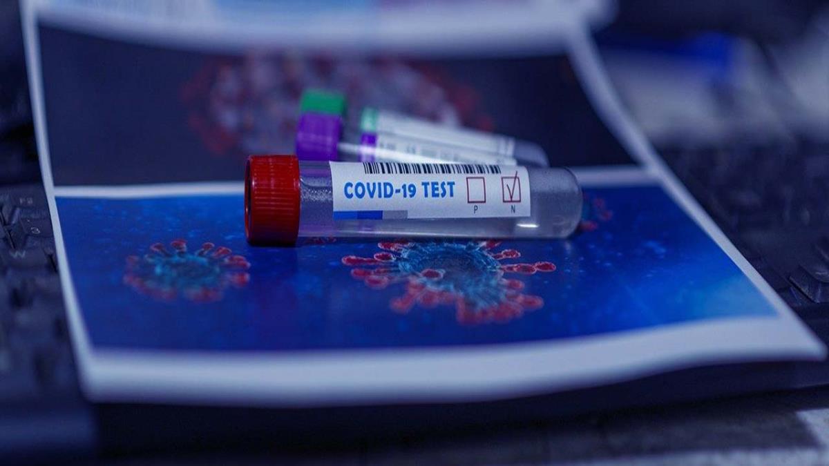 Esta iniciativa está dirigida a jóvenes de entre 18 y 29 años sean o no estudiantes universitarios