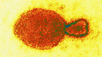 Un estudio científico reveló la detección de 35 contagios de este virus de origen animal 