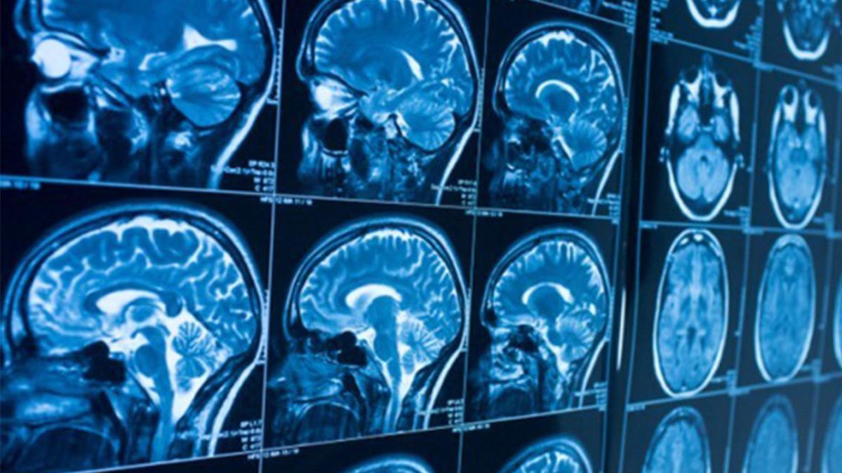 Según un estudio de la Universidad de Gotemburgo (Suecia)