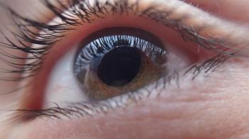 La neuropatía óptica glaucomatosa es la segunda causa de ceguera en el mundo
