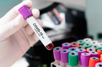 La Consejería de Sanidad finaliza este dispositivo tras analizar la evolución positiva de la pandemia