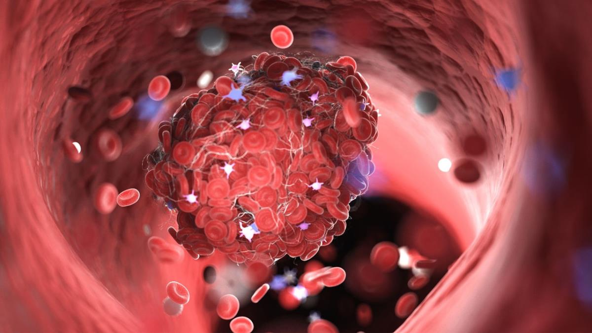 ¿Pueden afectar otras medicinas a este anticoagulante?