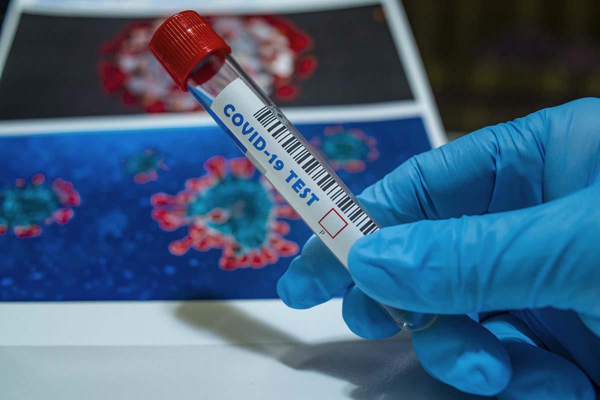 Investigadores de la Universidad de Alcalá realizan un estudio sobre una de las proteínas que tiene el virus 