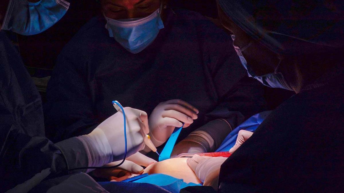 Con ella, permite un abordaje mínimamente invasivo para extirpar diversas porciones del hígado, a menudo para el tratamiento de tumores