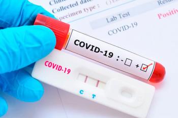 La zona esta confinada perimetralmente