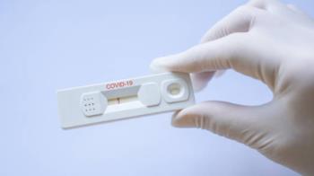 La autorización de venta para adquirir test de antígenos y serológicos en las farmacias se aprobará el 20 de julio en el Consejo de Ministros