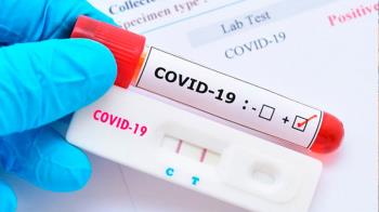 La Comunidad busca mantener un seguimiento de los contagios de la COVID-19