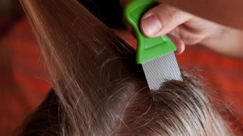 La OCU ha informado sobre las alternativas disponibles y sus ventajas y desventajas para desparasitarnos 