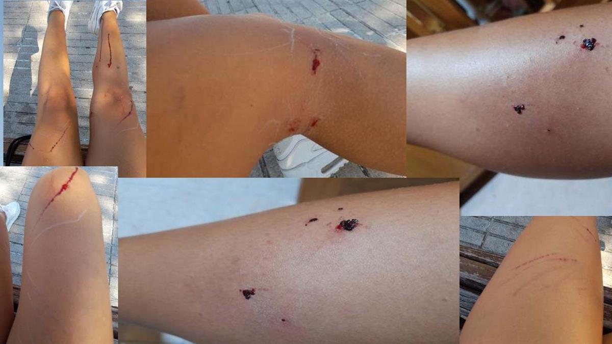 La dueña del gato ha denunciado el suceso en redes sociales